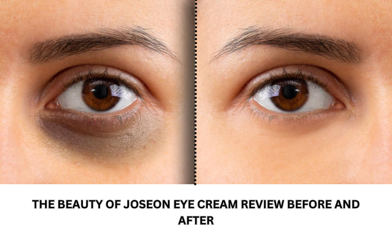 The beauty of Joseon eye cream review before and after